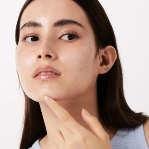 Moisturizer for Oily & Acne Prone Skin